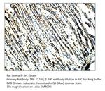 Src Antibody in Immunohistochemistry (IHC)