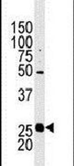 STC2 Antibody in Western Blot (WB)