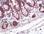 STC2 Antibody in Immunohistochemistry (IHC)