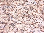 Stat5a Antibody in Immunohistochemistry (Paraffin) (IHC (P))