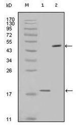 Survivin Monoclonal Antibody (2H5H2)
