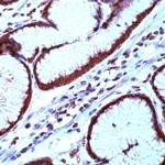 Survivin Antibody in Immunohistochemistry (IHC)