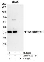 Synaptogyrin-1 Antibody in Western Blot (WB)