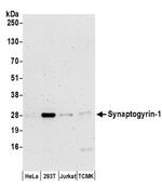 Synaptogyrin-1 Antibody in Western Blot (WB)
