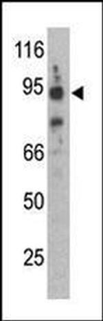 Synphilin 1 Antibody in Western Blot (WB)