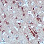Syntaxin 1 Antibody in Immunohistochemistry (IHC)