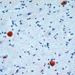 pan Synuclein Antibody in Immunohistochemistry (IHC)