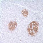 Synaptophysin Antibody in Immunohistochemistry (IHC)