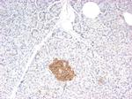 Synaptophysin Antibody in Immunohistochemistry (IHC)