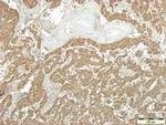 Synaptophysin Antibody in Immunohistochemistry (IHC)