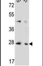 TM4SF4 Antibody in Western Blot (WB)