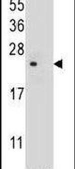 TM4SF4 Antibody in Western Blot (WB)