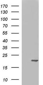 nm23-H1 Antibody in Western Blot (WB)