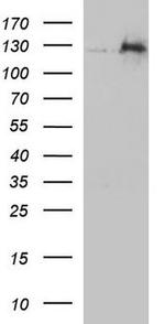 TSC1 Antibody in Western Blot (WB)