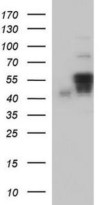 Annexin A7 Antibody in Western Blot (WB)