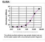 Cathepsin D Antibody in ELISA (ELISA)