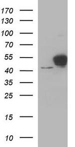 NSE Antibody in Western Blot (WB)