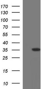 GCLM Antibody in Western Blot (WB)
