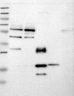 KPNA5 Antibody in Western Blot (WB)