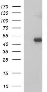 TSP50 Antibody in Western Blot (WB)