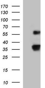 UBE2S Antibody in Western Blot (WB)