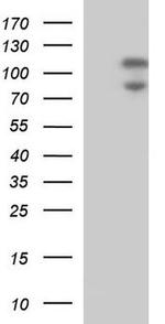 Lipin 2 Antibody in Western Blot (WB)