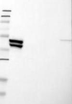 KRT23 Antibody in Western Blot (WB)