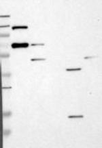 CC2D1A Antibody in Western Blot (WB)