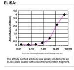 TRPV6 Antibody in ELISA (ELISA)