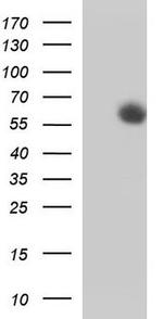 MCSF Antibody in Western Blot (WB)