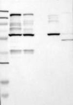 Liprin alpha 1 Antibody in Western Blot (WB)