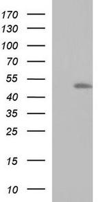 RNF39 Antibody in Western Blot (WB)