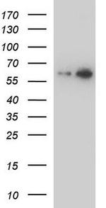 ALDH4A1 Antibody in Western Blot (WB)