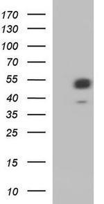 WTAP Antibody in Western Blot (WB)