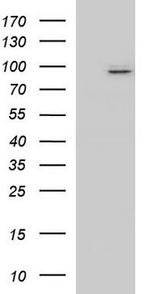 Microcephalin 1 Antibody in Western Blot (WB)