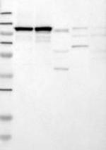 RBM15 Antibody in Western Blot (WB)