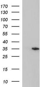 TLX3 Antibody in Western Blot (WB)