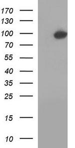 NAD Synthetase Antibody in Western Blot (WB)