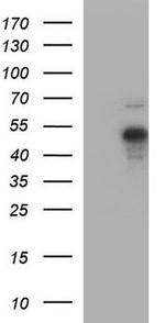PAX5 Antibody in Western Blot (WB)