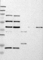ANKRD11 Antibody in Western Blot (WB)