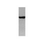 BRCA1 Antibody in Western Blot (WB)