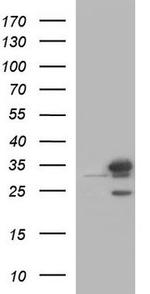 PROSC Antibody in Western Blot (WB)