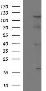 TIE1 Antibody in Western Blot (WB)