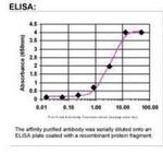 EPRS Antibody in ELISA (ELISA)