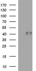 CTBS Antibody in Western Blot (WB)