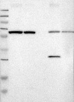 Ribophorin II Antibody in Western Blot (WB)