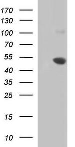 MASPIN Antibody in Western Blot (WB)