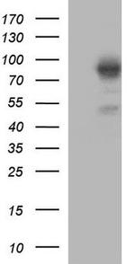 NBS1 Antibody in Western Blot (WB)