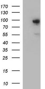 FES Antibody in Western Blot (WB)