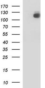 Aminopeptidase A/APA Antibody in Western Blot (WB)